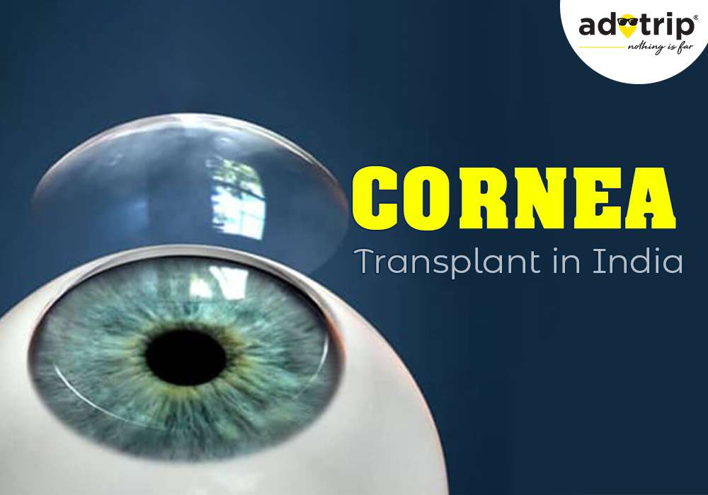 eye cornea transplant cost in india